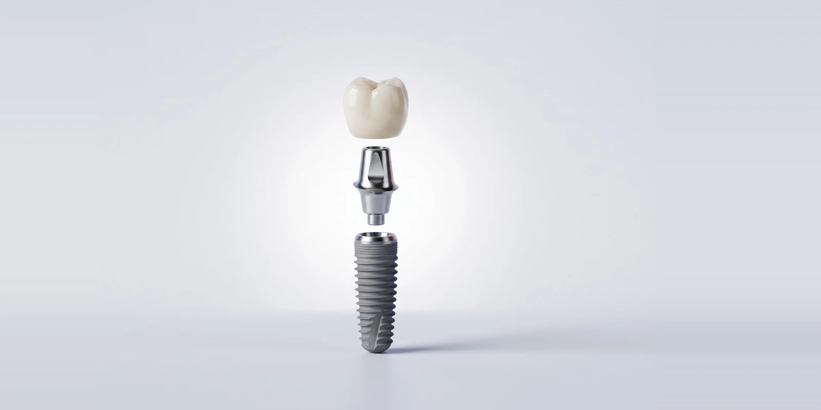 Parçalarına ayrılmış diş implantı: titanyum vida, abutment ve zirkonyum kron
